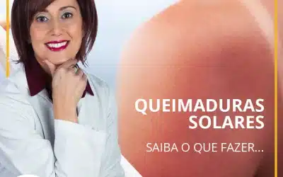 QUEIMADURAS SOLARES? SAIBA O QUE FAZER!