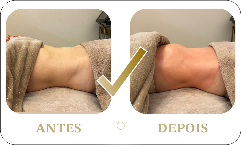 Prancheta 69